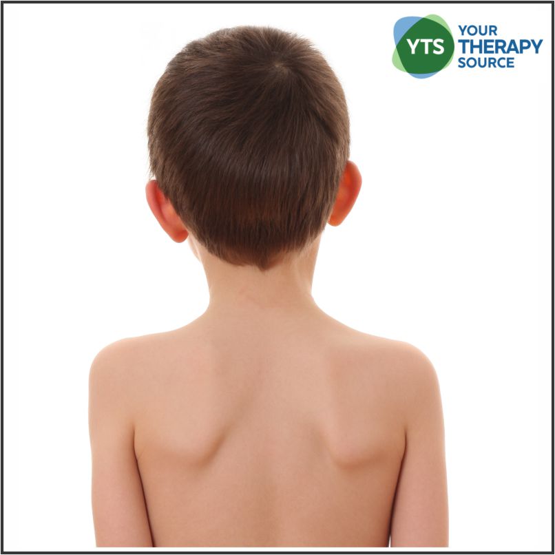 Want to Improve Hand Function in Cerebral Palsy? Try Neck and Trunk Exercises