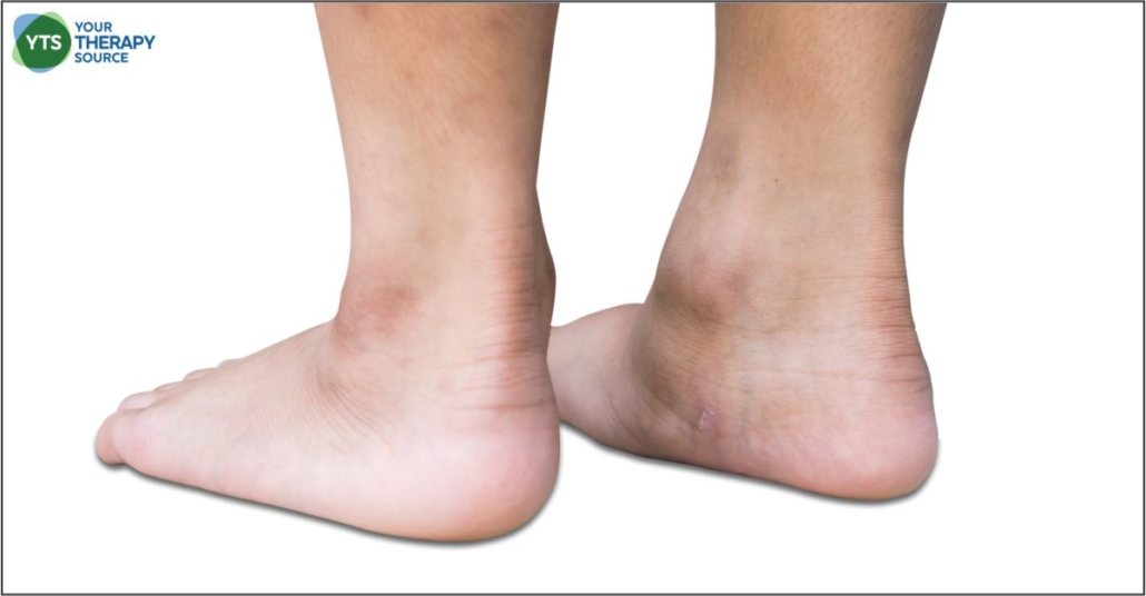 Kinesio Tape Balance and Children Your Therapy Source